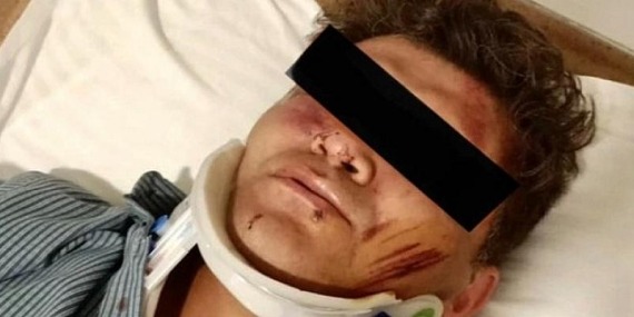 Sağlıkta şiddette geldiğimiz yer, sopalarla sokakta doktor dövmek