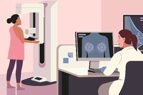 2-yilda-bir-onlem-amacli-mamografi-cekilmeli.jpg