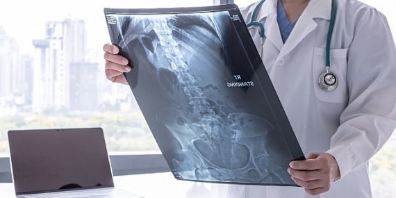 Kanser Önlenebilir Bir Hastalıktır!