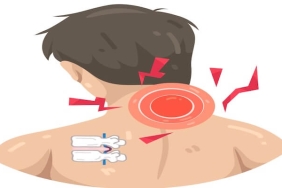 Boyun Fıtığı Ameliyatı: Ne Zaman Gerekir, Hangi Yöntemler Uygulanır?