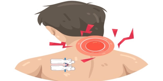 Boyun Fıtığı Ameliyatı: Ne Zaman Gerekir, Hangi Yöntemler Uygulanır?