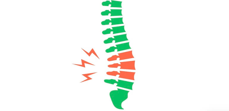 Omurga Kırığı Ameliyatı: Modern Tedavi Yöntemleri ve Başarı Oranları