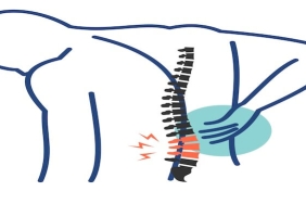 Günümüzde Osteoporoz