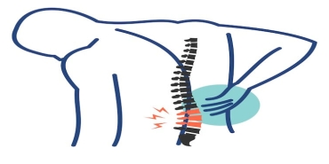 Günümüzde Osteoporoz